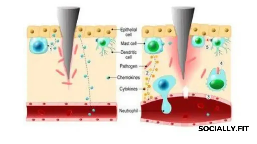 Can Inflammation cause Weight Gain